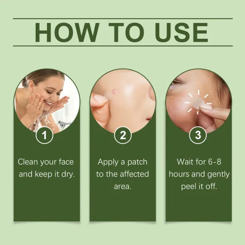 OUHOE Anti-Blemish Pore Patch – Gentle Acne Care and Skin Recovery