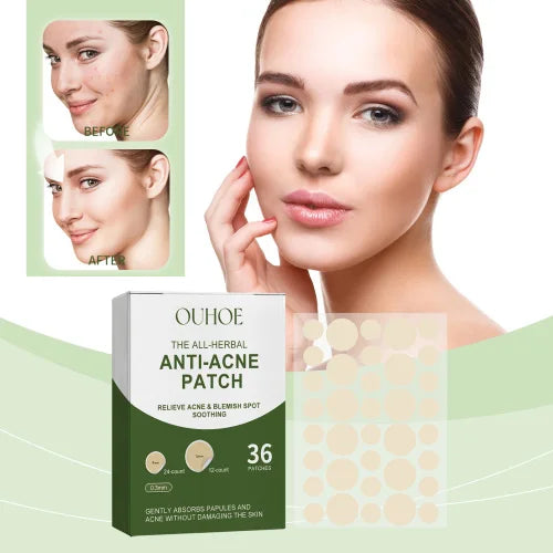 OUHOE Anti-Blemish Pore Patch – Gentle Acne Care and Skin Recovery